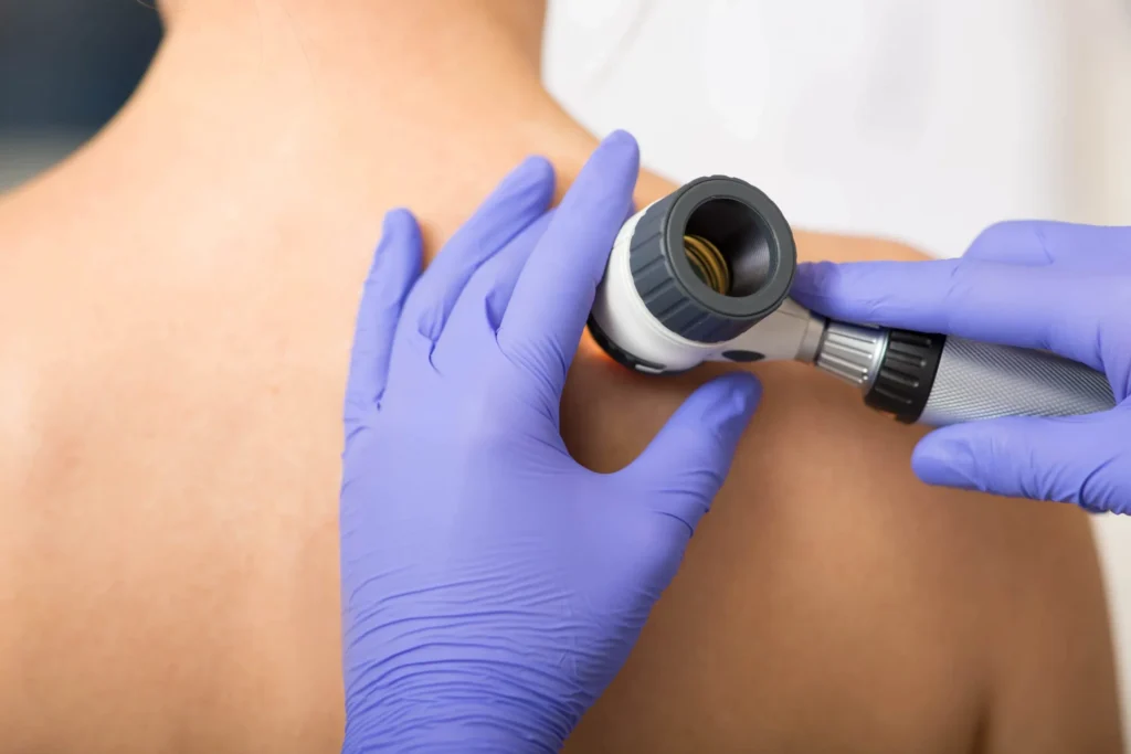 Banner promoting skin cancer screening services.