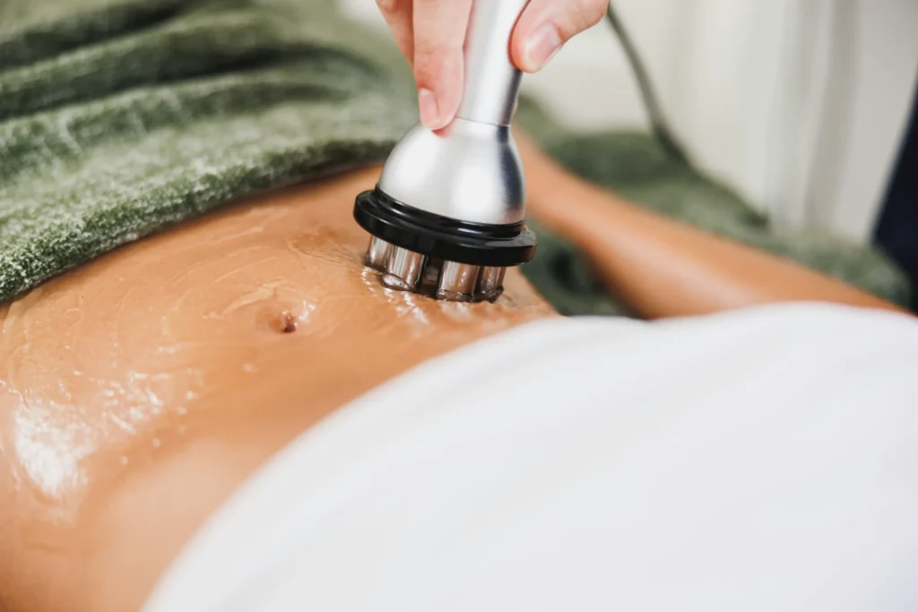 A close-up of a woman's abdomen being treated with a device.
