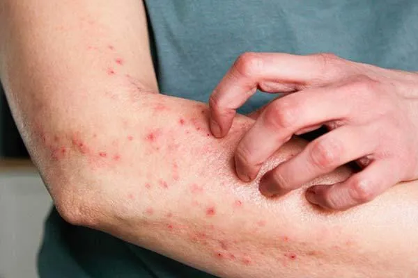 Image depicting various skin conditions.