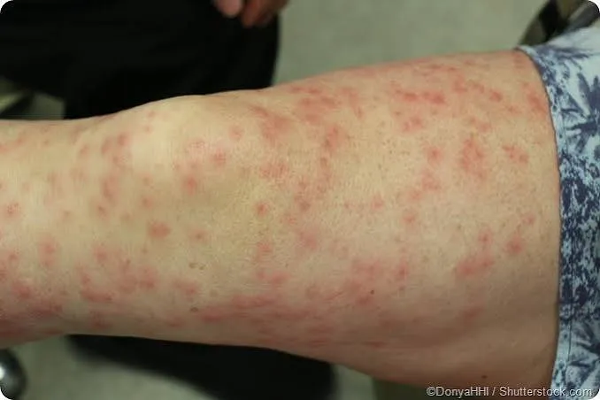 A visual representation of various skin conditions.